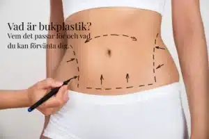 bukplastik