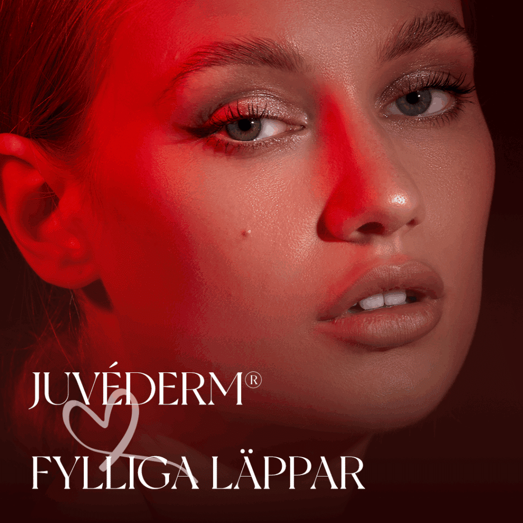 juvederm fillers