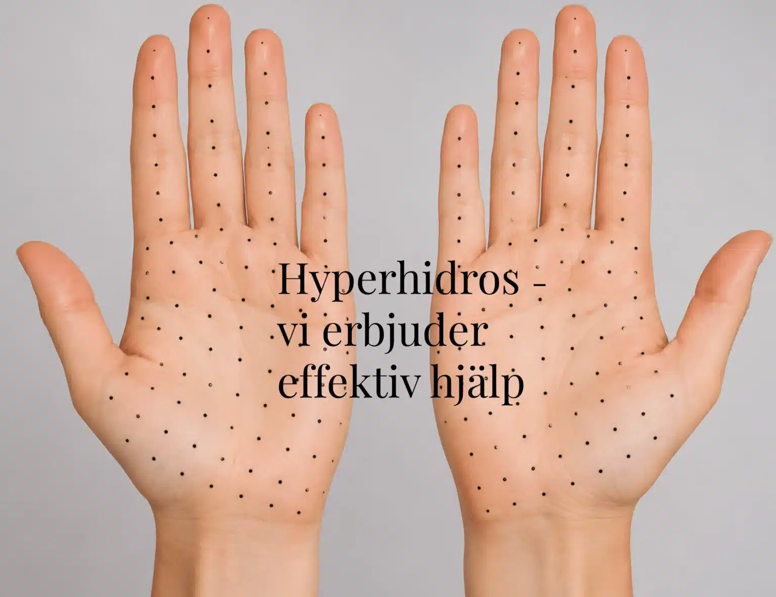 hyperhidros blogg